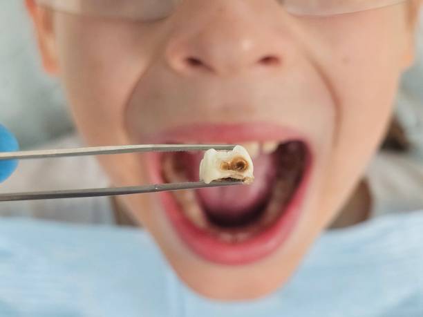 Best Emergency Dentist for Knocked-Out Tooth in Prophetstown, IL